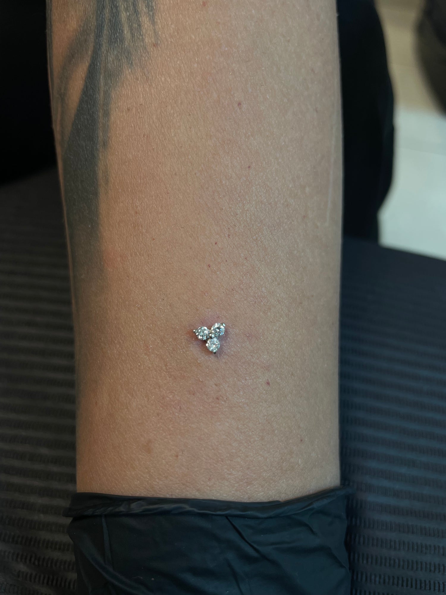 Diamond White Gold Trinity Dermal Top