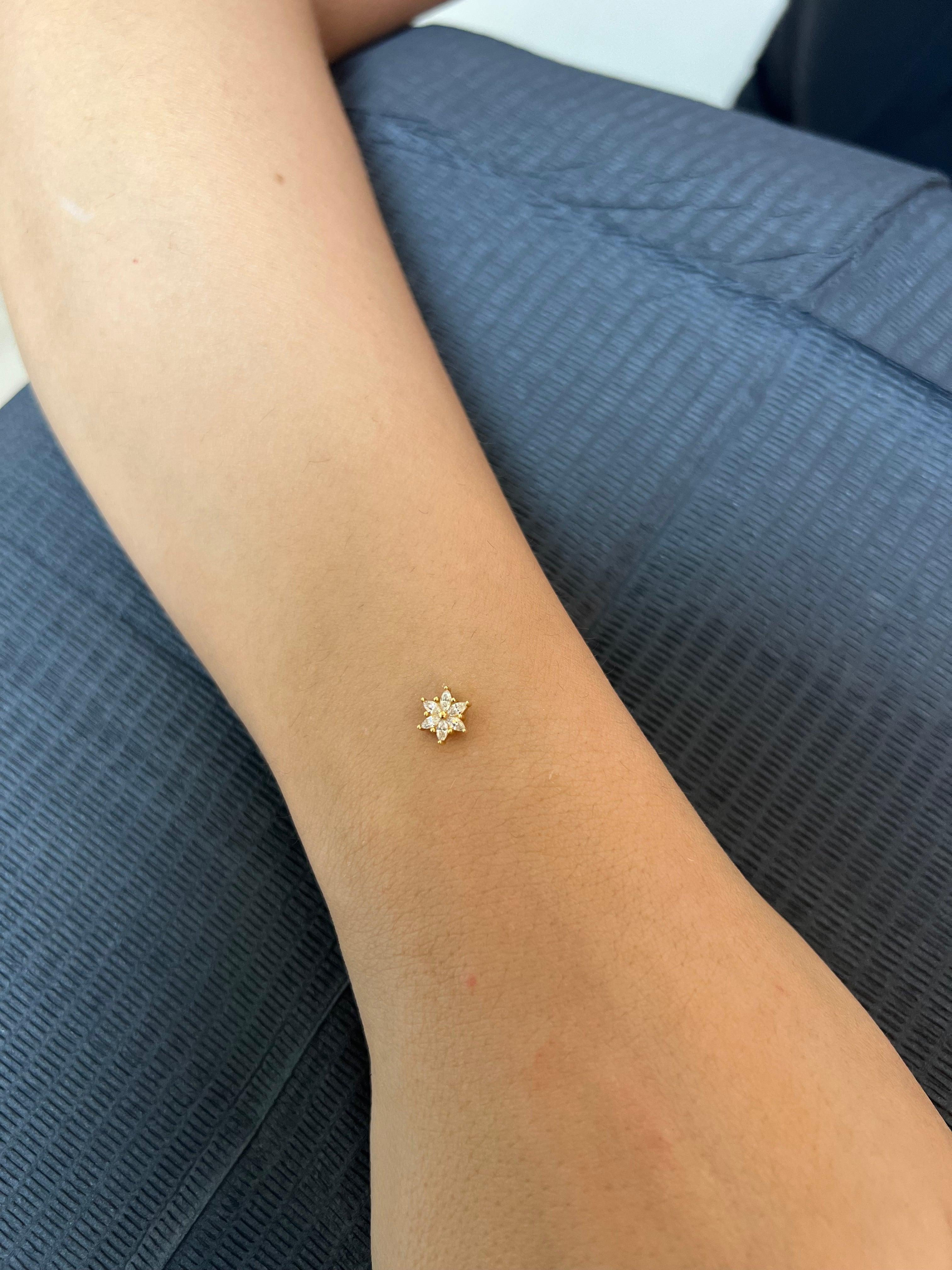 Gold Marquise Blossom Dermal Top