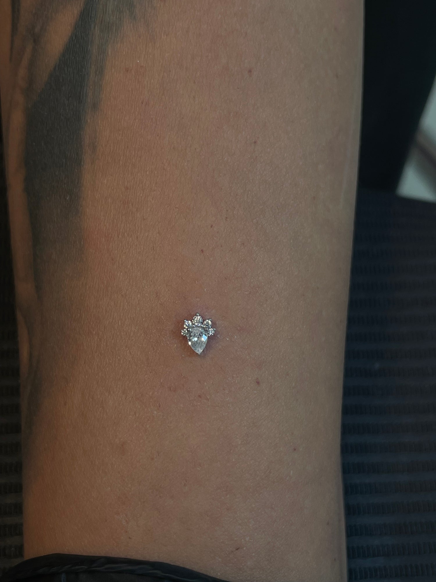 White Gold Frosted Petal Dermal Top