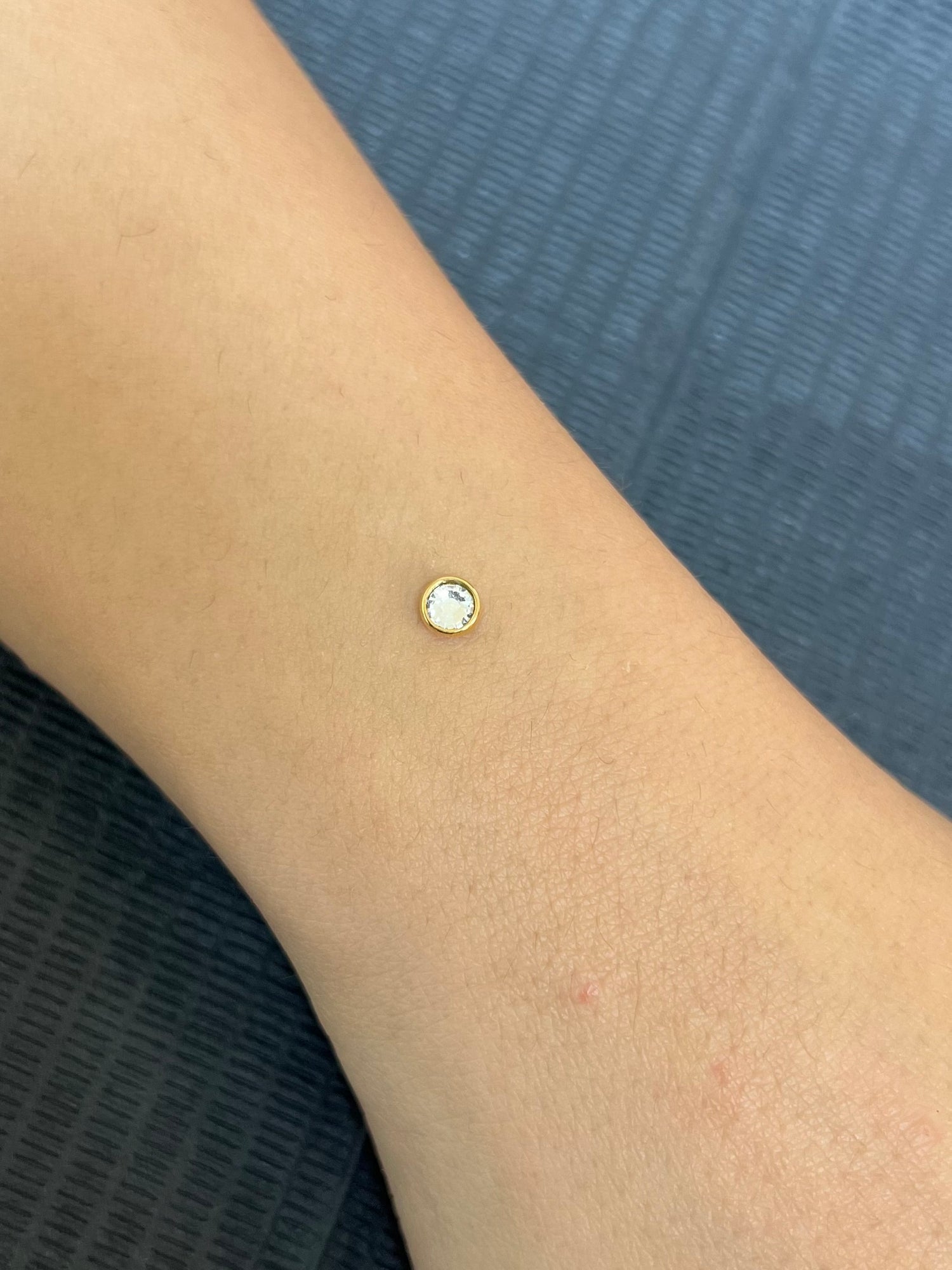 Gold Round Sparkle Dermal Top