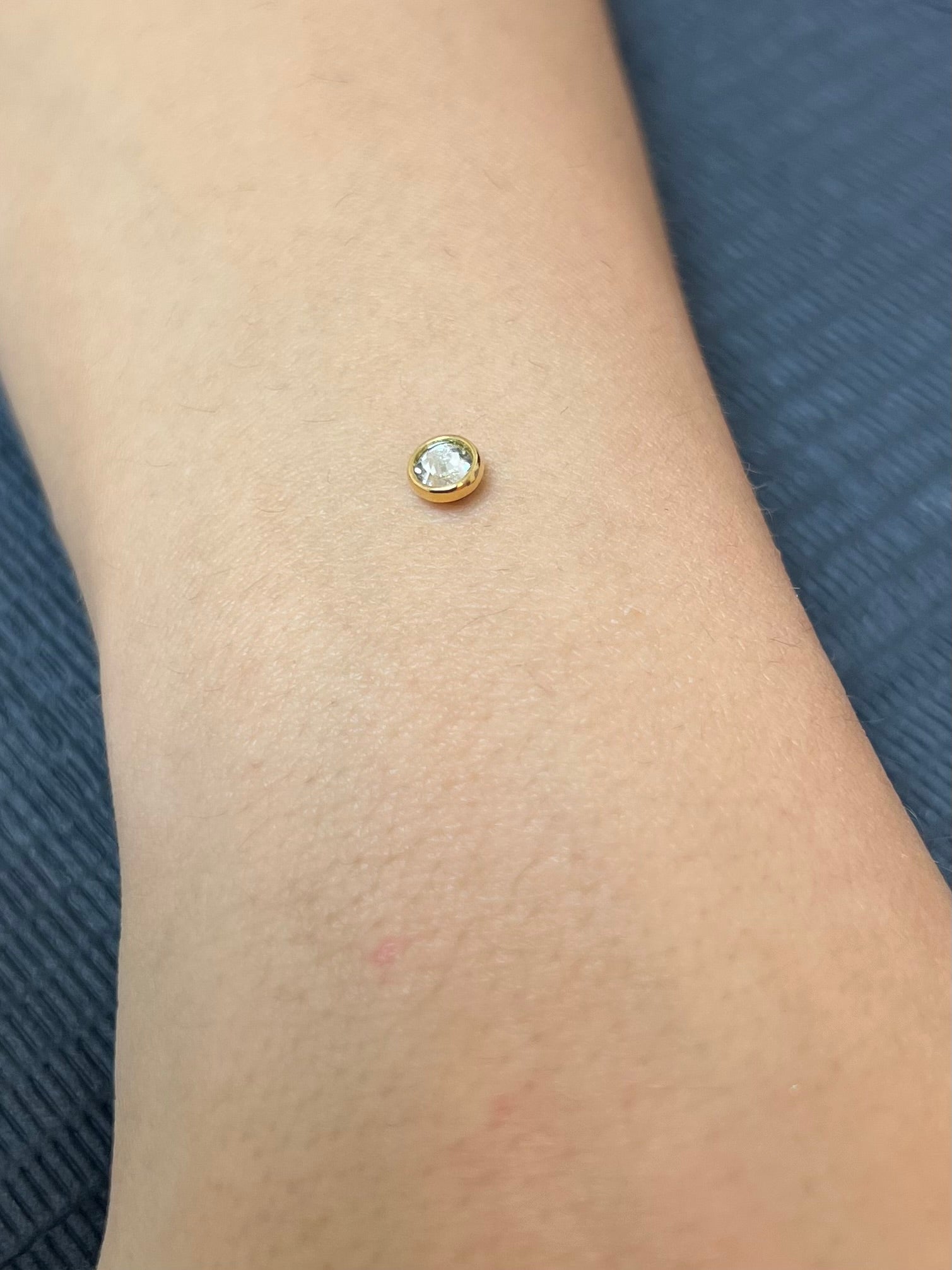 Gold Round Sparkle Dermal Top