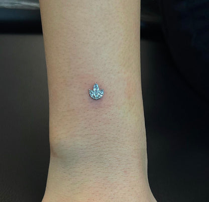 Titanium Dermal-Surface Top 6