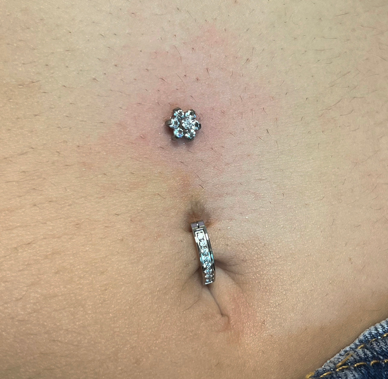 Titanium Belly 1