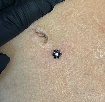 Titanium Dermal-Surface Top 4