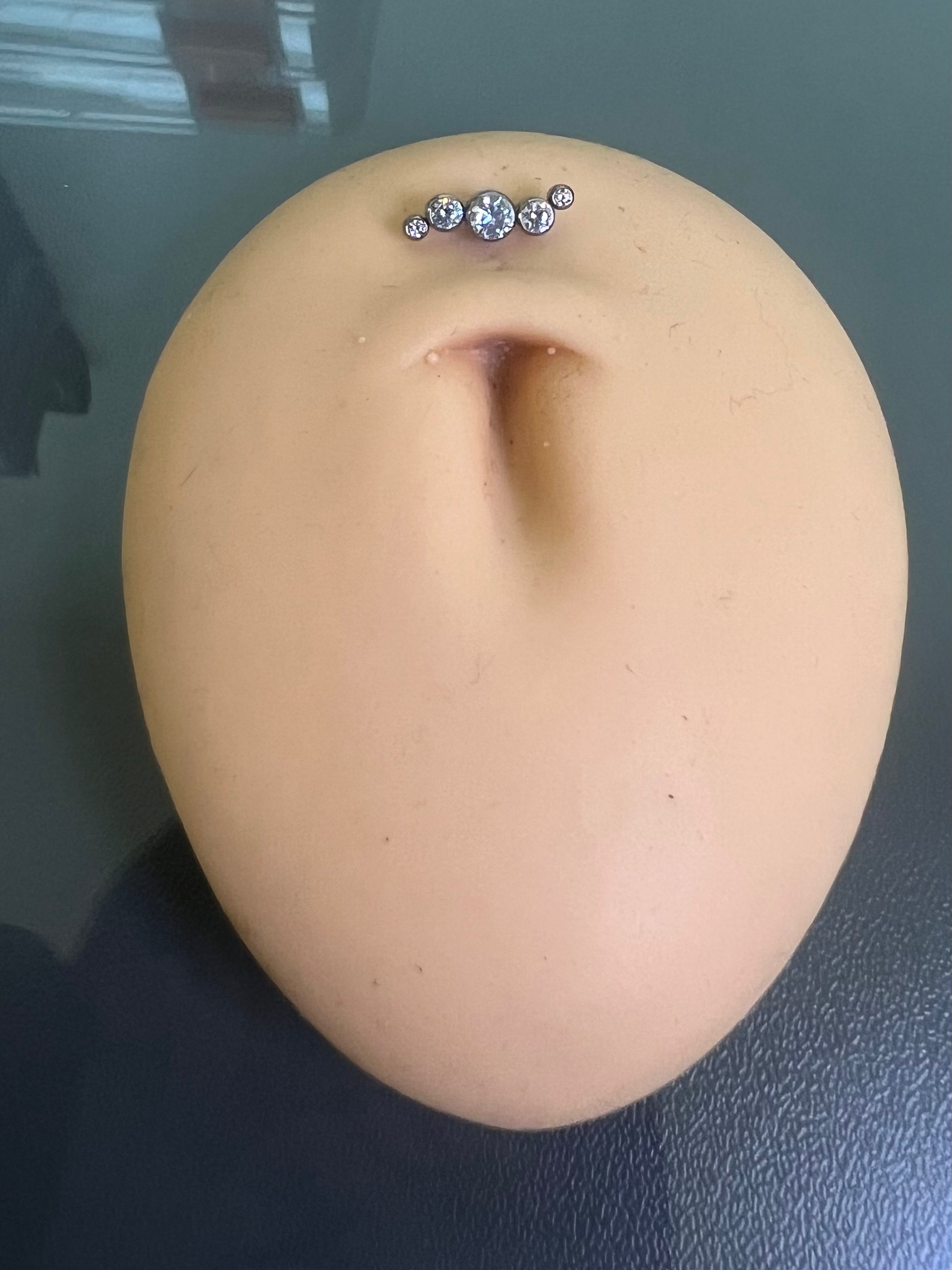 Titanium Dermal-Surface Top 9