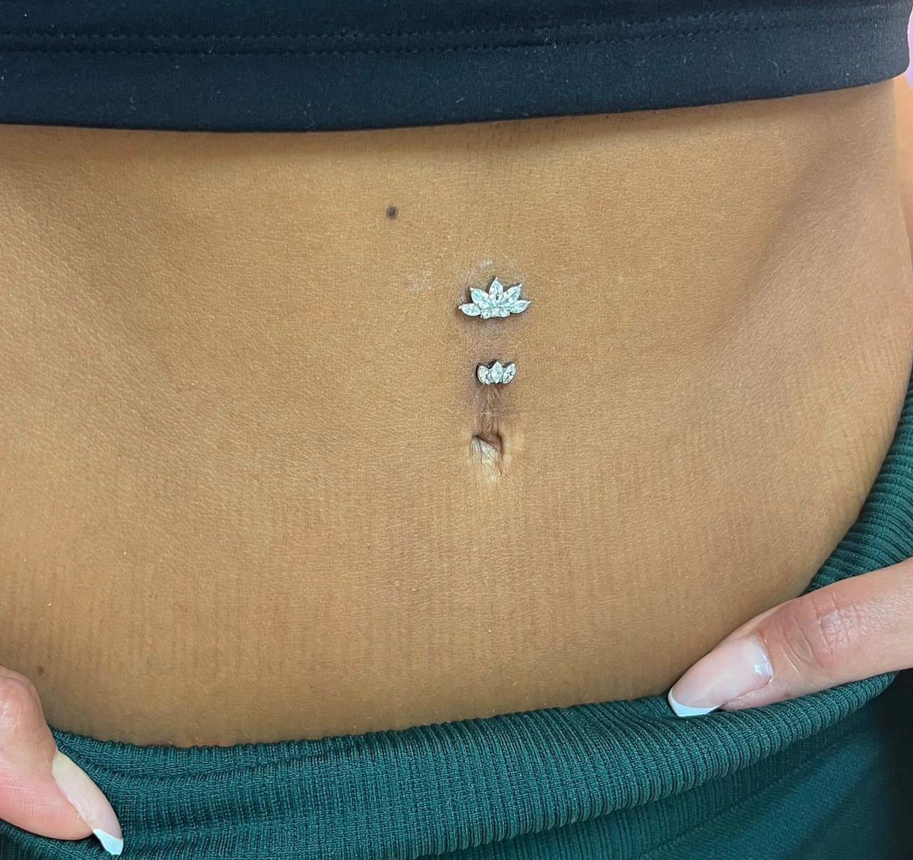 Titanium Dermal-Surface Top 18